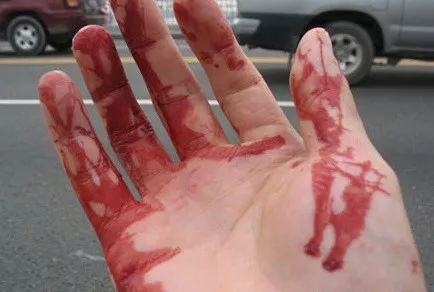 手掌带血的真实图片图片
