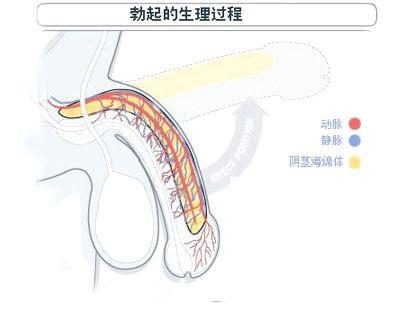 如果勃起时动脉供血不足,或者关闭不严,海绵体内压就会不足,阴茎勃起