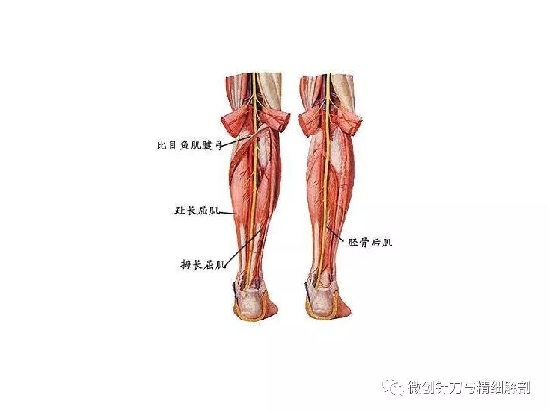 人体精细解剖