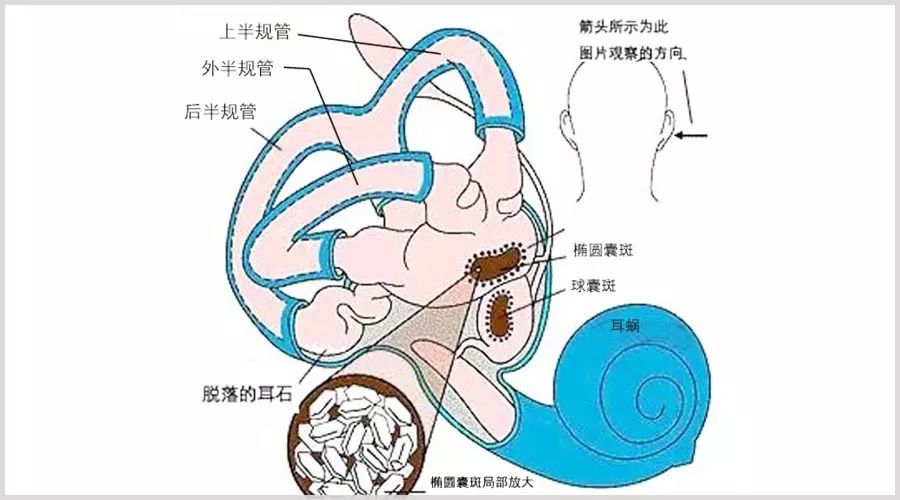 在我们耳朵的内部,除了负责听力的耳蜗之外,还有专门负责前庭功能的