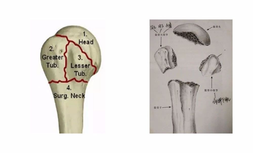肱骨近端骨折neer分型图片
