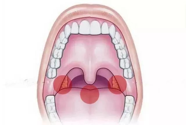 口咽位置图片
