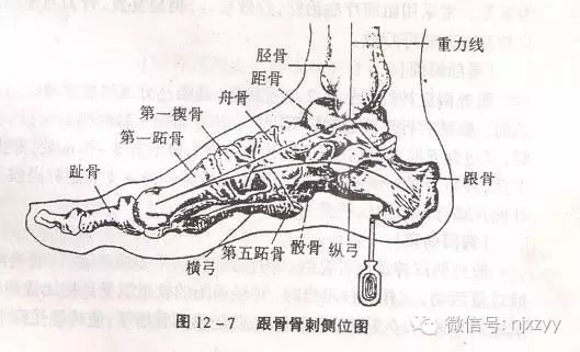 右跟骨前缘的位置图图片