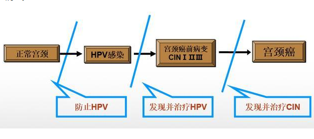 在这个过程中,只要在宫颈癌之前的几个阶段,能做个hpv