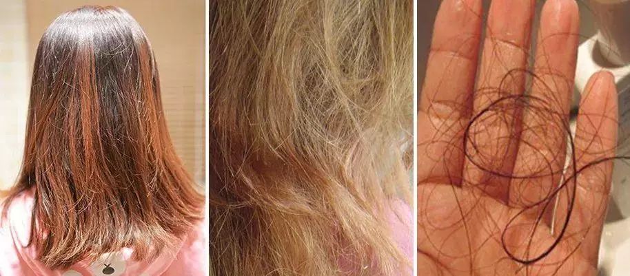发质变得脆脆的,还会让头发患上结节性脆发病,头发就会渐渐变得枯黄