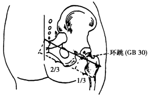 [定位] 在臀区,股骨大转子凸点与骶管裂孔连线的外1/3与内2/3交点处