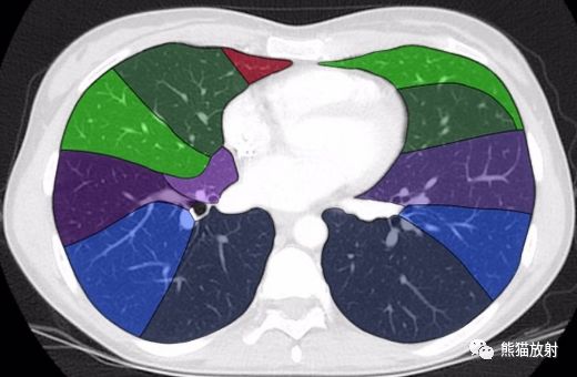 解剖丨支氣管肺段分佈
