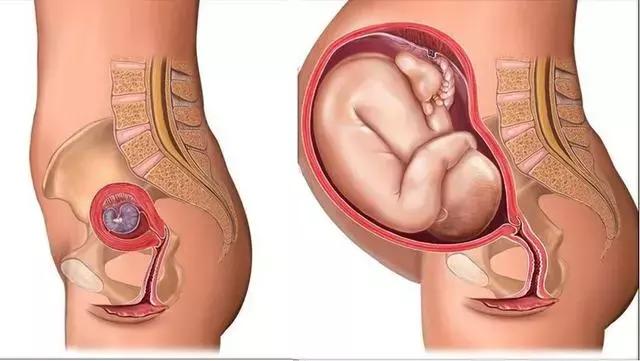 怀孕后子宫位置图图片