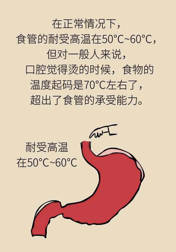 常吃火鍋易得食管癌這些人應每年做一次胃鏡檢查