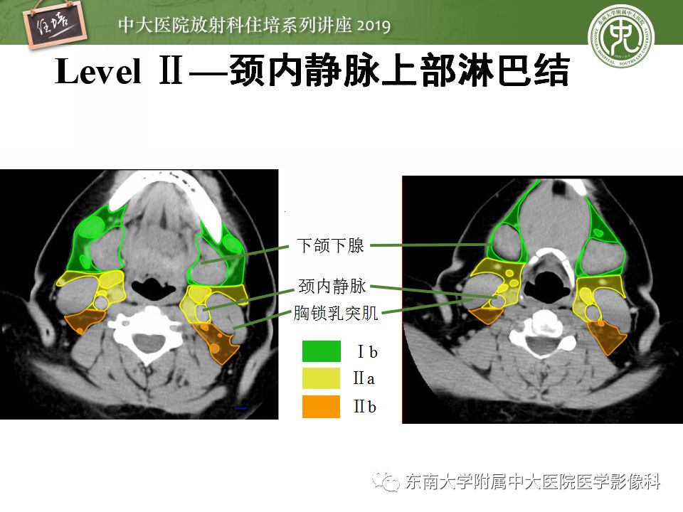 颈部淋巴结ct解剖图图片