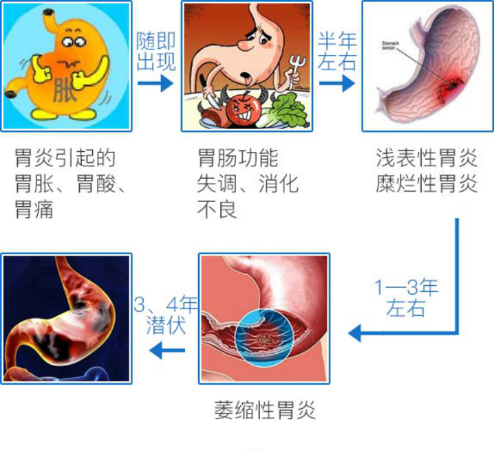 從胃炎到胃癌只有四步這樣做最安全