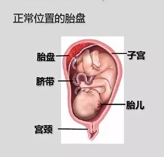 正常的胎盘位置图片