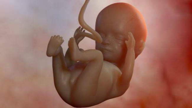九十天的胎儿图片欣赏图片