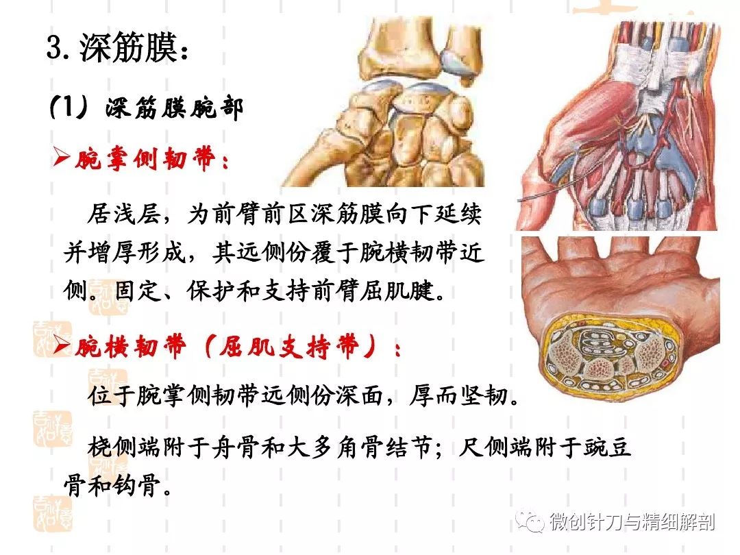 掌侧韧带图片