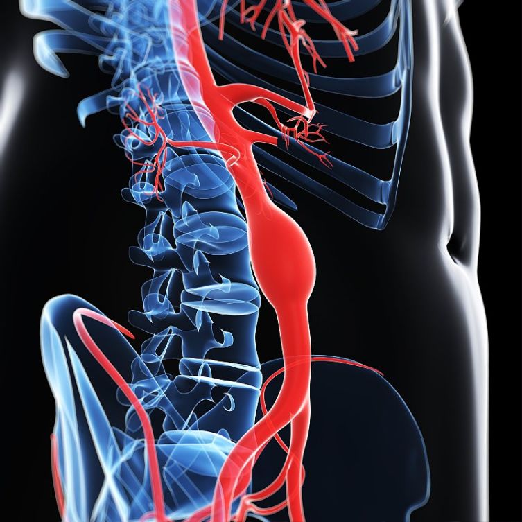 背部动脉分布图图片