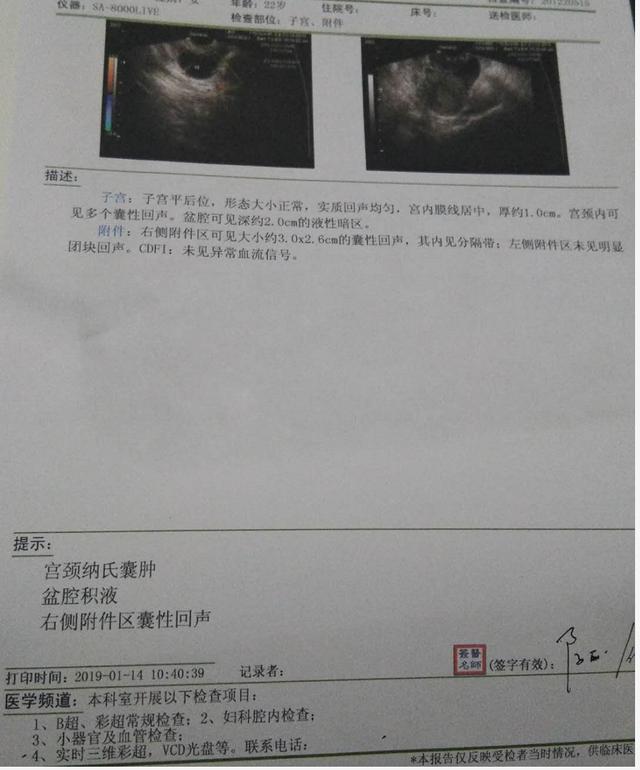 女性右侧阴囊肿图片图片