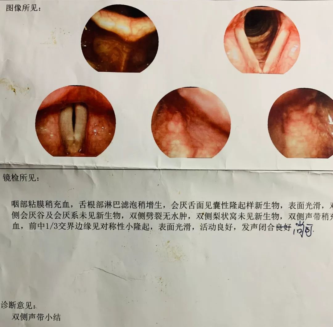 一个正常人的喉镜图片图片