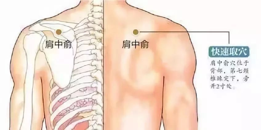 另外,患者日常應有針對性地加強頸肩部肌肉鍛鍊,糾正不良姿勢,避免