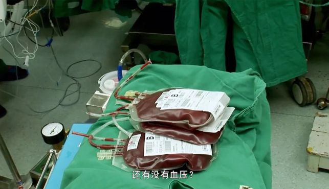 38歲女子生產大出血輸血一萬多毫升生和死只差毫釐