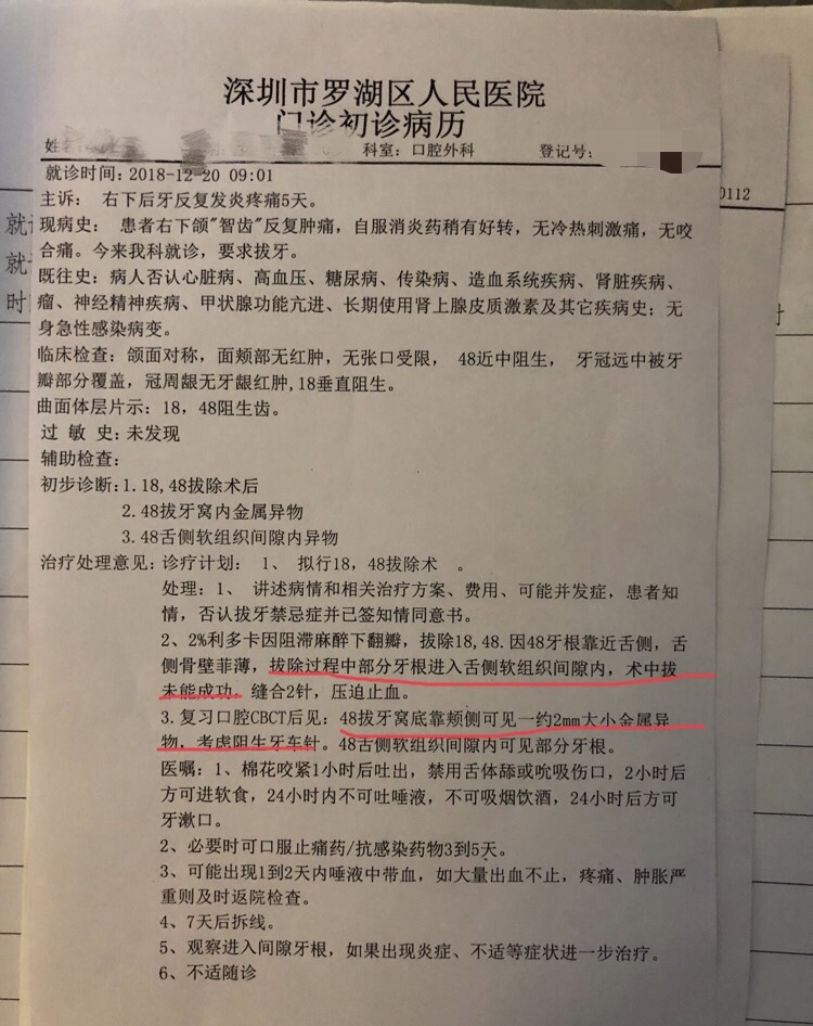 阻生齿拔除病历模板图片