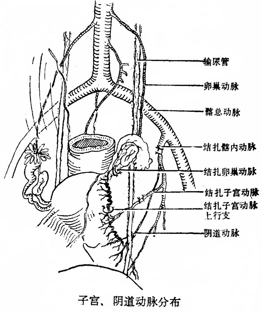 卵巢血管解剖图图片