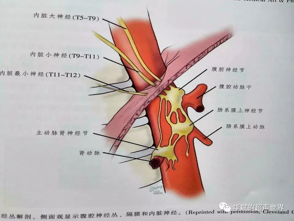 膀胱副神经节瘤图片