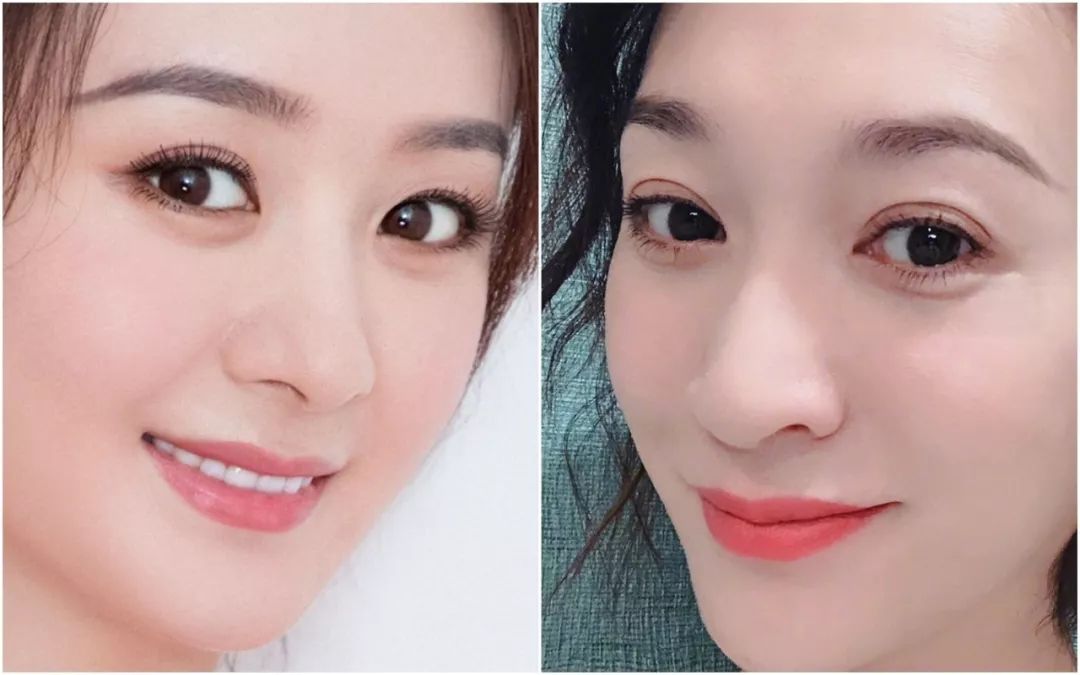 韩国最新整容模板,终于知道为什么割的双眼皮那么难看了