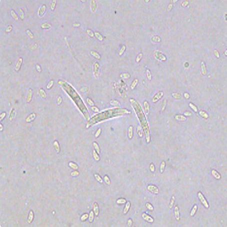 该病菌主要侵染西瓜 分生孢子有大型和小型之分