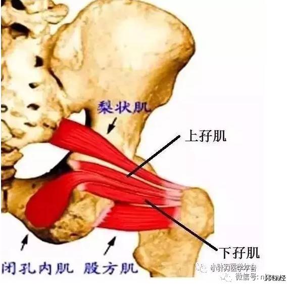 2,上,下孖肌,股方肌,閉孔內肌刺激壓迫坐梨狀肌因急,慢性損傷,或加上