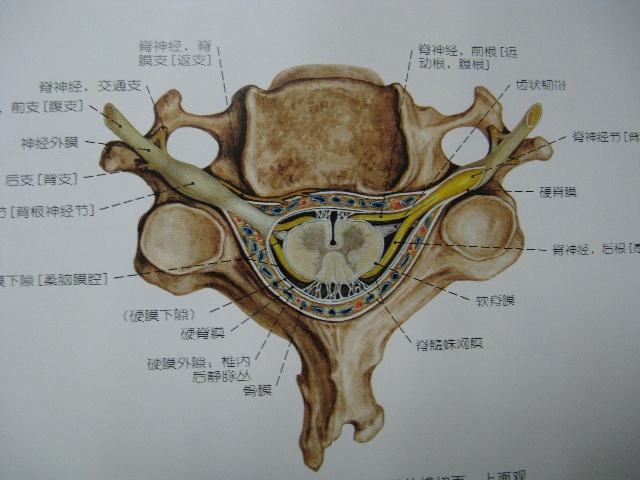 食管压迫型颈椎病图片图片