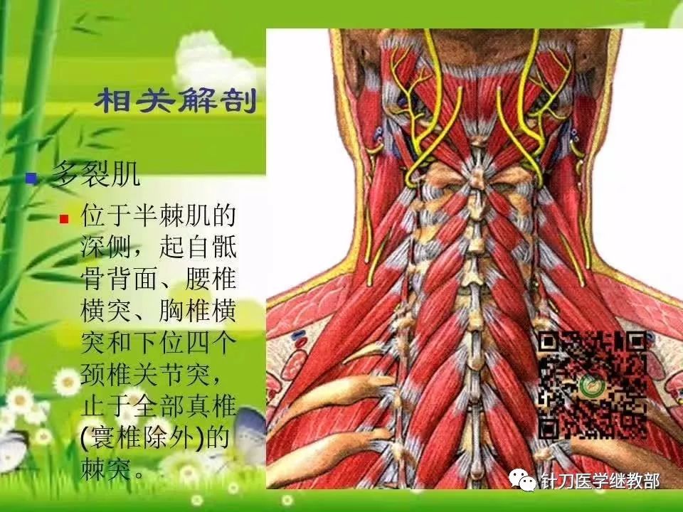 【課件分享】頸部肌損傷的針刀治療