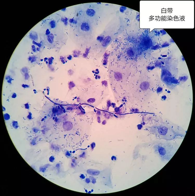 细菌简单染色图片