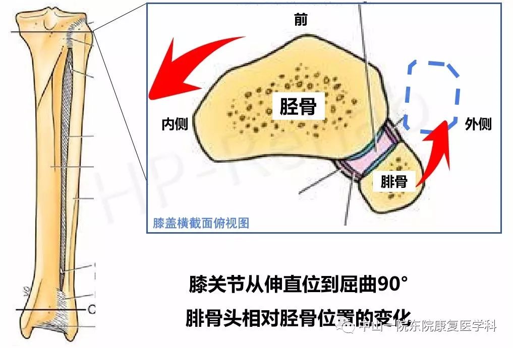 胫骨外旋和内旋的区别图片