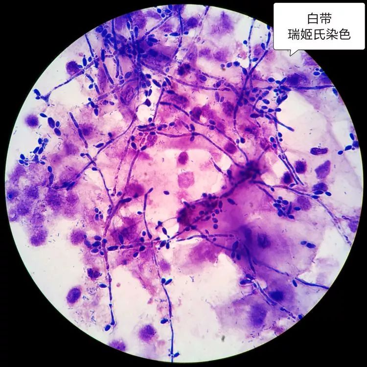 vonkossa染色图片