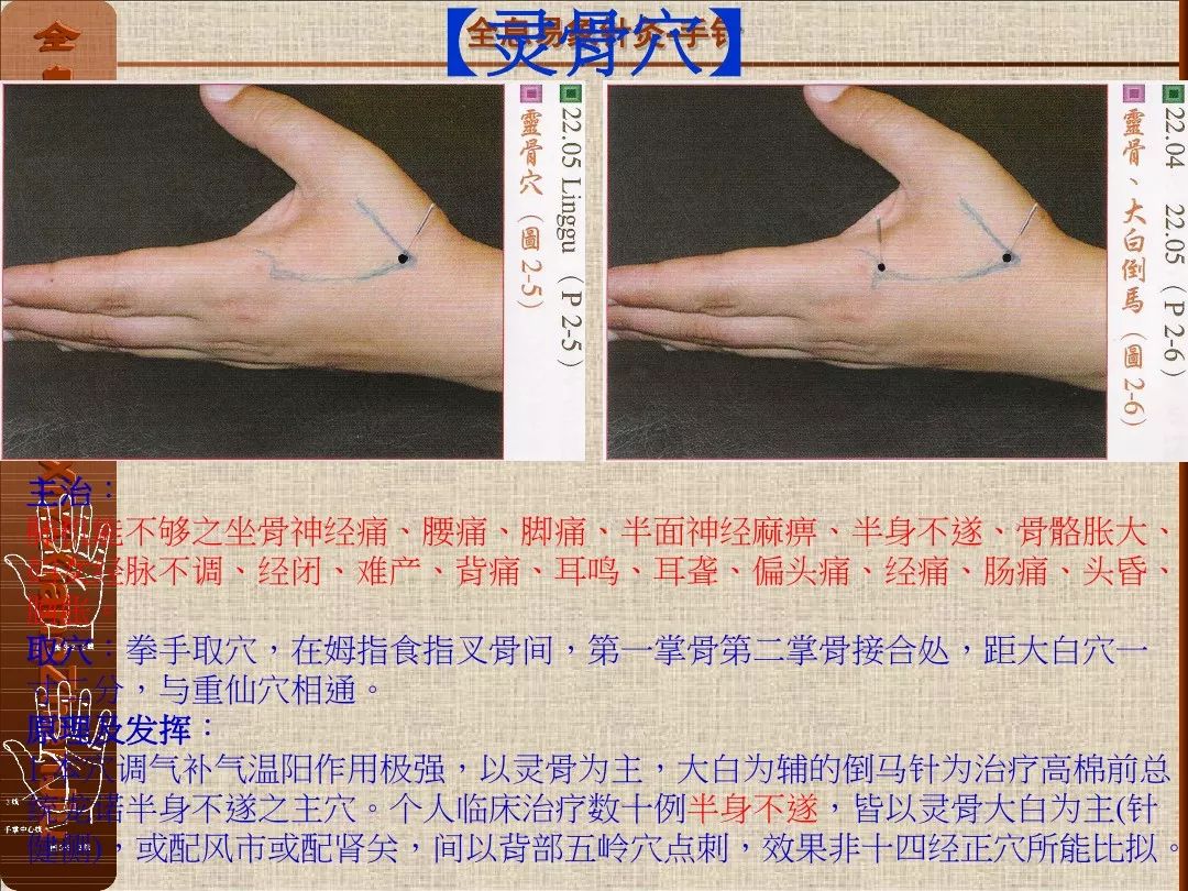 手针呃逆点位置图片图片