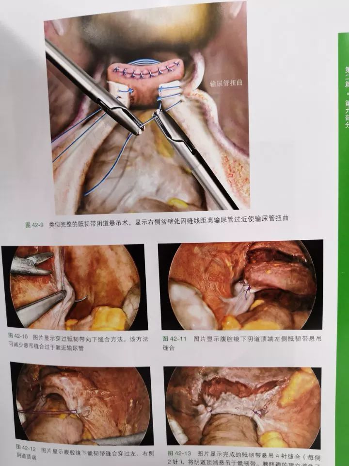 女性B型大全盆腔图片