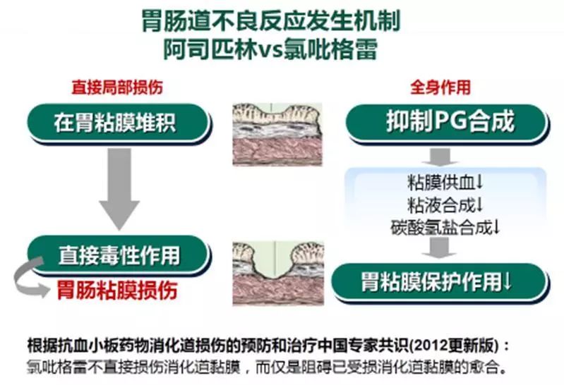 的胃镜随访观察结果显示,阿司匹林导致的消化道黏膜损伤长期持续存在