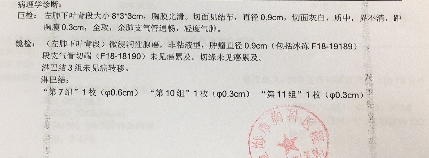 肺癌检查报告单图片图片