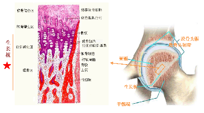 骨板 结构图图片