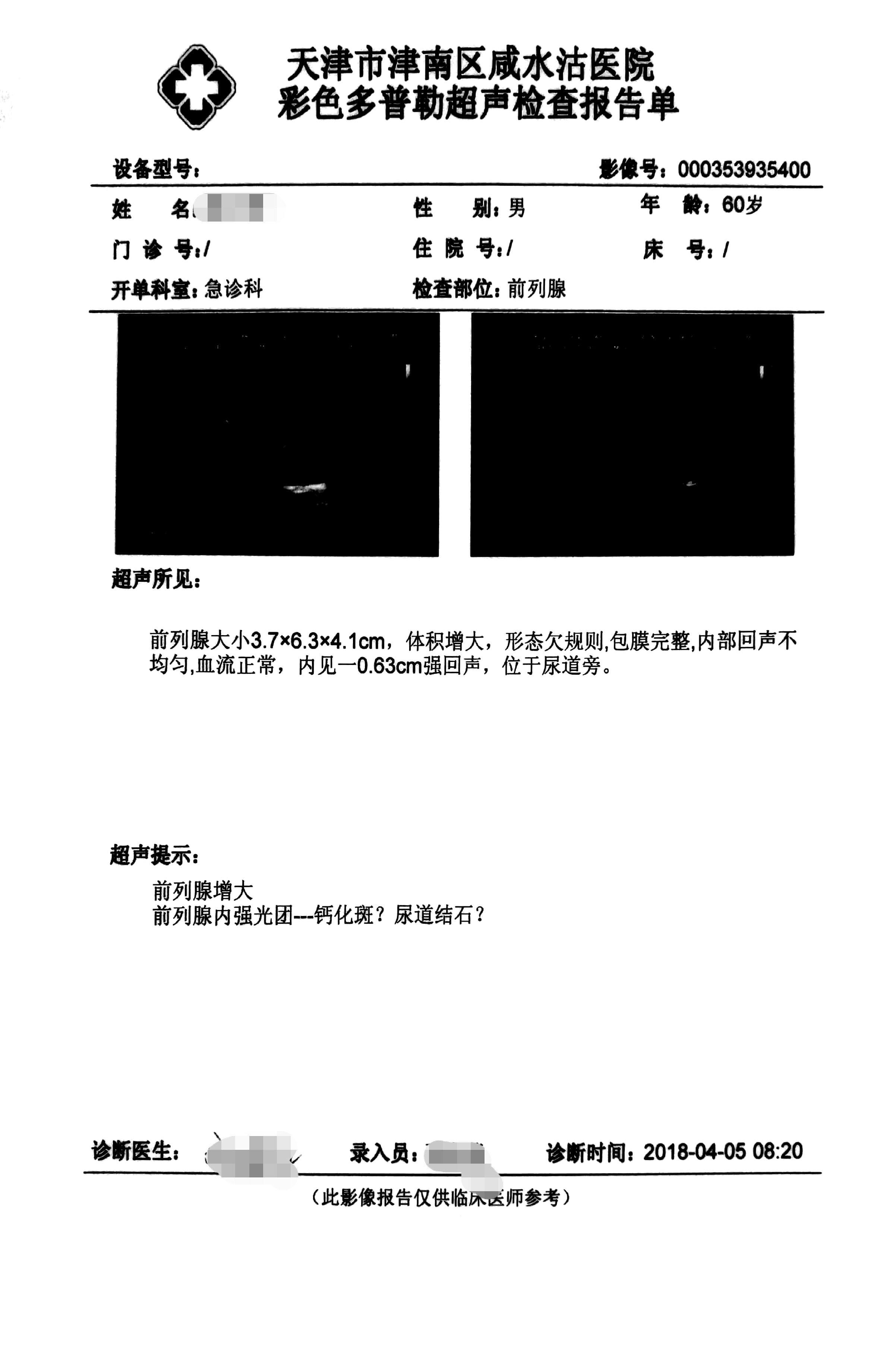 超声检查报告单图片图片