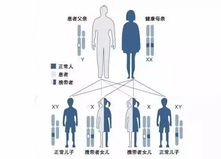 秃顶基因的遗传图解图片