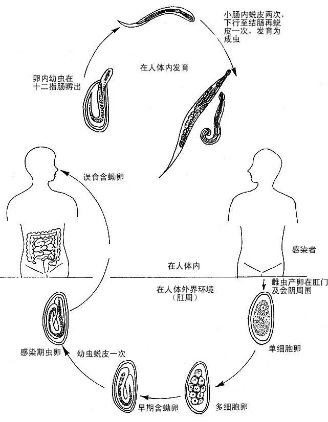 白线虫图片大全及说明图片