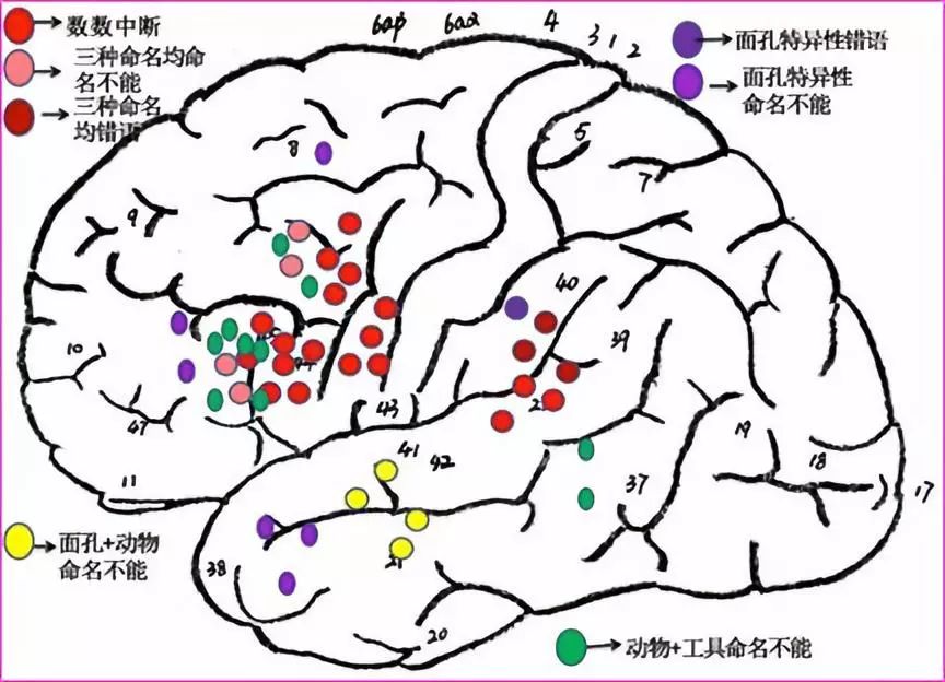 神刀博覽南部戰區總醫院王偉民2018版喚醒下大腦功能區手術技術指南