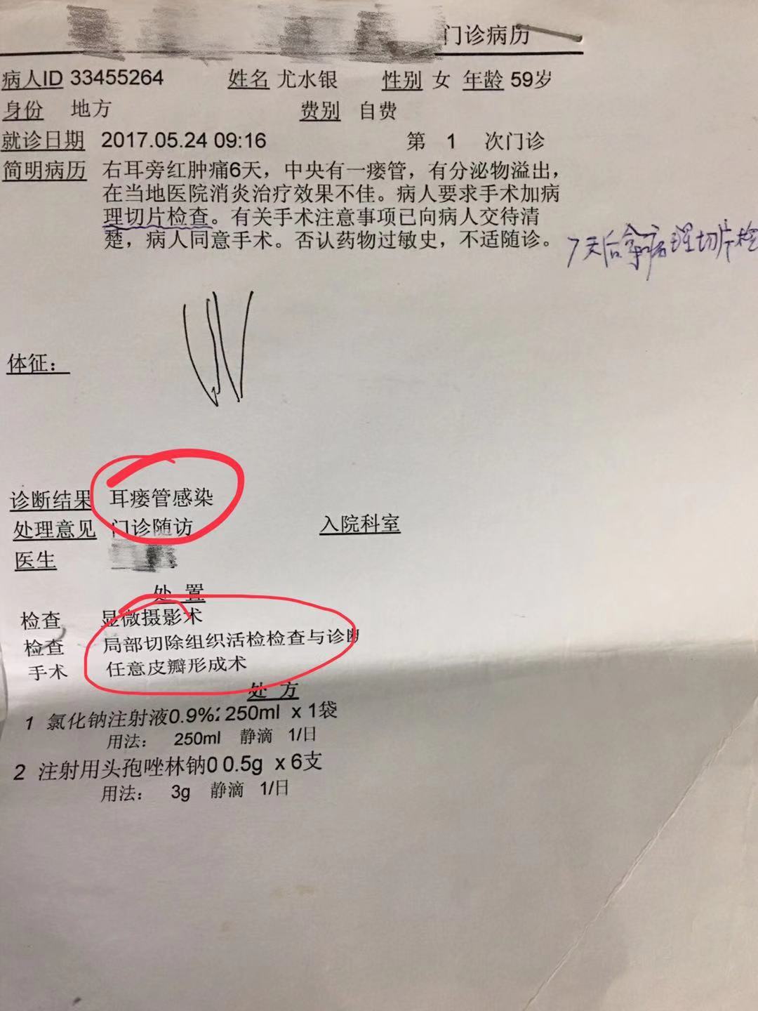 耳前瘘管红肿