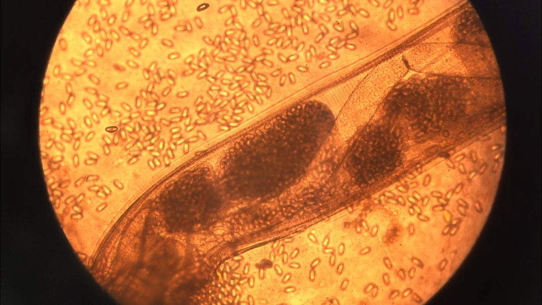 蛲虫卵 显微镜图片