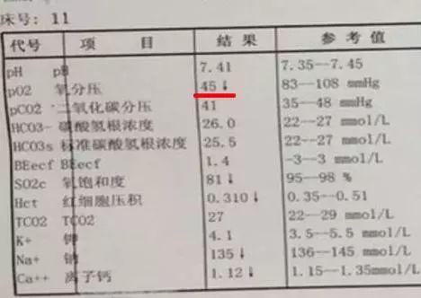 動脈血氣誤抽了靜脈血?這3點幫你輕鬆辨別!