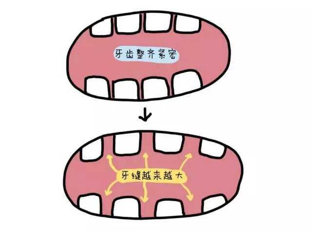 医声年轻姑娘一排牙全被拔光郑州大学附属郑州中心医院陈卓小心变成