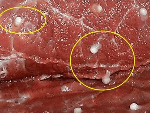 人体感染猪肉绦虫症状图片