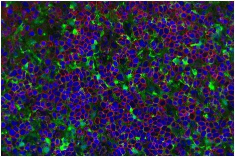 cellstemcell重大突破首次诱导多能干细胞产生杀死肿瘤细胞的成熟