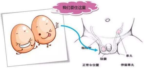 儿童睾丸发育图片图片